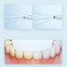 Изображение товара «Ирригатор Mijia Electric Teeth Flosser (F300) White» №10